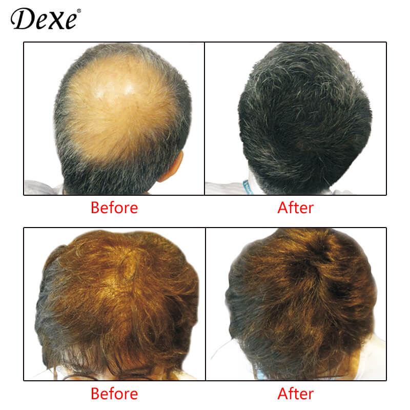 Dexe Hair Building Fiber For Thickening Covering baldness - Hair Powder for both Men and Women