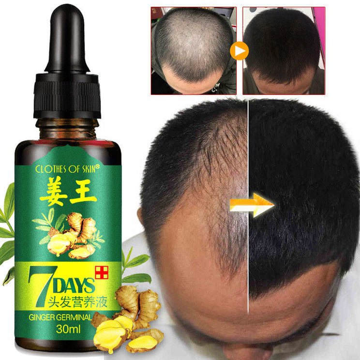 Intense Hair Growth oil