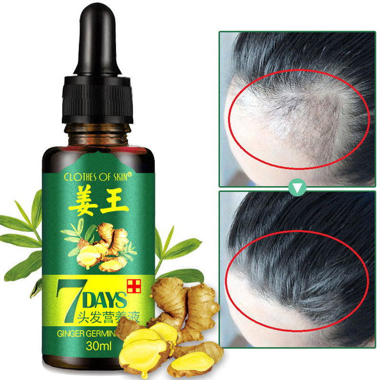 Intense Hair Growth oil